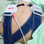 pain hurt miscarriages